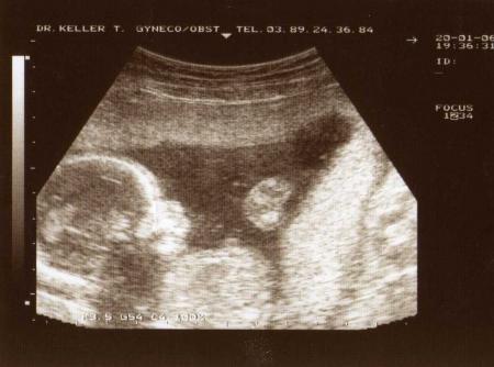 Brian dans le bidon de sa maman